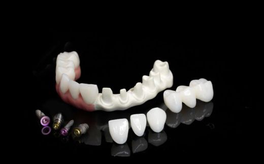 A milled Zantex framework with teeth, on black.